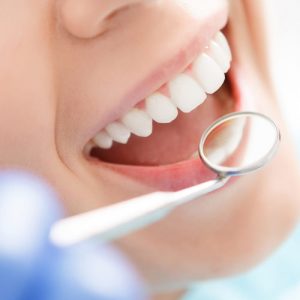 معاینه دندان‌پزشکی